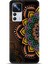 Xiaomi Mi 12T Pro Kılıf Hd Baskılı Kılıf - Followed Institution 0337 1