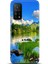 Xiaomi Mi 10T Pro Kılıf Hd Baskılı Kılıf - Followed Institution 0133 1