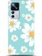 Xiaomi Mi 12T Pro Kılıf Hd Baskılı Kılıf - Followed Institution 0381 1
