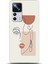 Xiaomi Mi 12T Pro Kılıf Hd Baskılı Kılıf - Followed Institution 0172 1