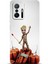 Xiaomi Mi 11T Kılıf Hd Baskılı Kılıf - Followed Institution 0140 1