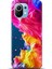 Xiaomi Mi 11 Kılıf Hd Baskılı Kılıf - Followed Institution 0599 1