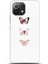 Xiaomi Mi 11 Lite Kılıf Hd Baskılı Kılıf - Followed Institution 0334 1