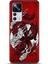 Xiaomi Mi 12T Pro Kılıf Hd Baskılı Kılıf - Followed Institution 0145 1