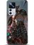 Xiaomi Mi 12T Kılıf Hd Baskılı Kılıf - Followed Institution 0299 1