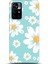 Xiaomi Poco M4 Pro 5g Kılıf Hd Baskılı Kılıf - Followed Institution 0381 1