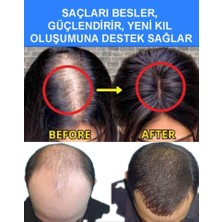 Purexpose  Mavi Serum 3 Adet + Dermaroller