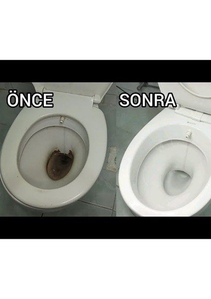 Güçlü Formül Tuvalet Temizleyici - Sol Toı