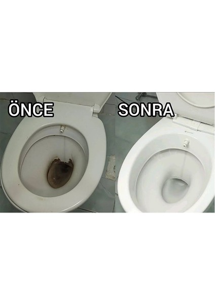 Wc Sarı Leke Temizleme Jeli - Sol Wc Perfect Jel