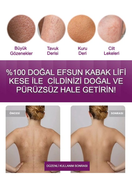 Doğal Kabak Kesesi Lif Selülite Batık ve Sivilcelere Son Özel Peeling Etkisi