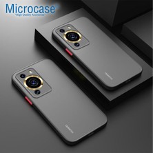 Microcase Huawei P60 Pro / P60 London Serisi Darbeye Dayanıklı Kılıf - Siyah AL3415