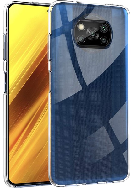 Xiaomi Poco X3 Nfc Önce Karşıtı Izleme See-Through Net Soft Tpu Kasa Kapağı (Yurt Dışından)