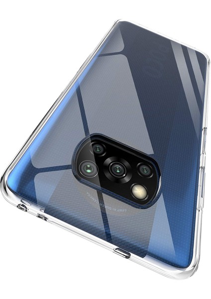 Xiaomi Poco X3 Nfc Önce Karşıtı Izleme See-Through Net Soft Tpu Kasa Kapağı (Yurt Dışından) fırsatları