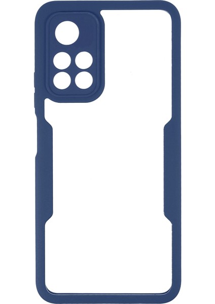 360 Derece Koruma Akrilik+Tpu Hibrit Telefon Kılıfı Kapak Xiaomi Için Pet Ekran Filmi Redmi Not 11 5g (Çin) (Mediatek)/redmi Not 11T 5g/redmi Not 11S 5g-Dark Mavi (Yurt Dışından) modelleri