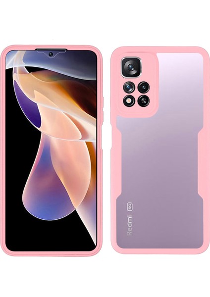 Kamera Lens Koruyucu Pet Ekran Filmi+Akrilik+Tpu Telefon Kılıfı Xiaomi Redmi Için Tam Vücut Koruma Kapağı Not 11 Pro 5g (Çin) (Mediatek)/not 11 Pro+5g-Pink (Yurt Dışından)