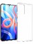 10PCS/XIAOMI Için Paket Redmi Not 11 5g (Çin) (Mediatek)/not 11T 5g/not 11S 5g Iç Filigransız Net Mobil Kasa Yumuşak Tpu Telefon Kabuğu (Yurt Dışından) 1