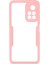 360 Derece Koruma Akrilik+Tpu Hibrit Telefon Kılıfı Pet Screen Film ile Xiaomi Redmi Not 11 5g (Çin) (Mediatek)/redmi Note 11T 5g/redmi Not 11S 5g-Pink (Yurt Dışından) 4
