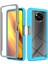 Xiaomi Poco X3/poco X3 Pro/poco X3 Nfc Giyim Karşıtı Pc+Tpu Hibrid Koruyucu Koruma Pet Ekranı Koruyucu Baby Mavi ile 3'ü 1 Arada Telefon Kapağı (Yurt Dışından) 1