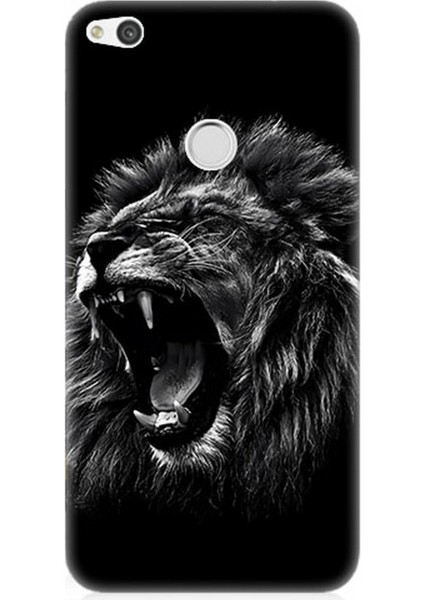 Huawei P9 Lite 2017 Uyumlu Silikon Kılıf Saldırgan Aslan