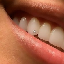 Heppii 5'li Paket Kadın Diş Pırlantası Kristal Diş Taşı Svarovski Tooth Gam