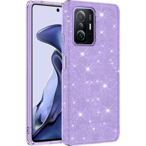 Xiaomi Mi 11T Simli Parlak 5g Kılıf Zore Shining Silikon