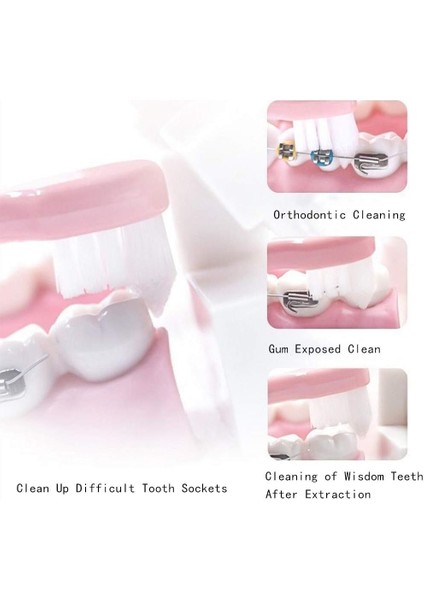 Fırçalar 4 Parça Tuft Diş Fırçası Minik Küçük Baş Ucu Püskül Diş Fırçası, Ortodontik Yumuşak Trim Wisdom Diş Fırçası Tekli Kompakt Diş Arası Fırçası (Tekli) (Yurt Dışından) fırsatları