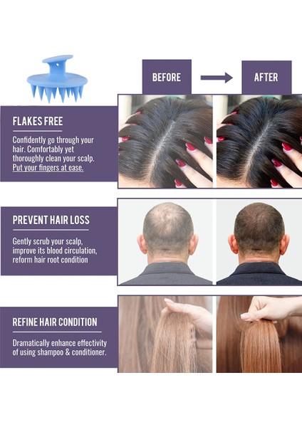 Fırçalar Masaj Silikon Şampuan Kafa Derisi Temizleme Kuaförlük Şampuan Tarağı (Yurt Dışından) indirimleri