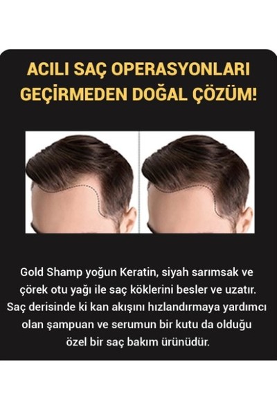 Enoment Cosmetic Goldshamp Men Keratin Özlü Şampuan 200 ml - Enoment Cosmetic