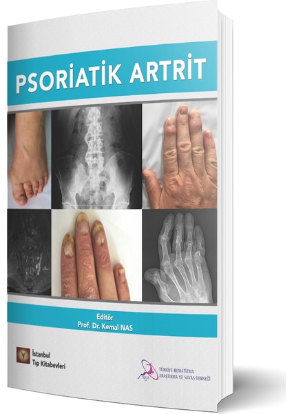 Psoriatik Artrit - Kemal Nas