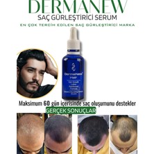 Dermanew Dermanew Hair Losyon / 3 Losyon +Roller