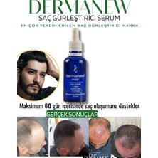 Dermanew Dermanew Hair Losyon / 3 Losyon +Roller