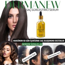 Dermanew Dermanew Hair Losyon / 1 Losyon+ Roller