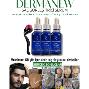 Dermanew Hair Losyon / 3 Losyon +Roller