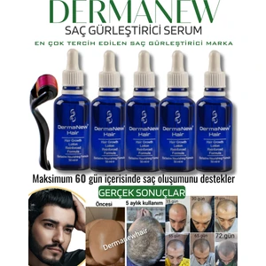 Dermanew Hair Losyon / 5 Losyon + Roller