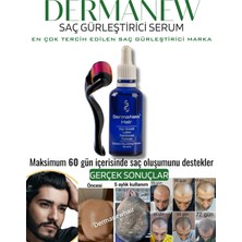 Dermanew Dermanew Hair Losyon / 1 Losyon +Roller 1X50 ml