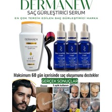 Dermanew Dermanew Hair Losyon / 3 Losyon +Roller +Şampuan