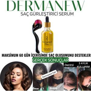 Dermanew Hair Losyon / 1 Losyon+ Roller