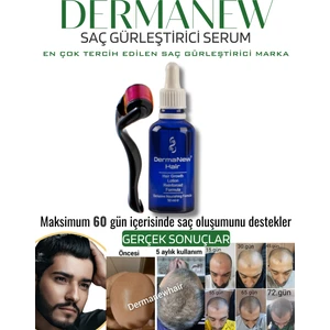 Dermanew Hair Losyon / 1 Losyon +Roller 1X50 ml