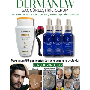 Dermanew Hair Losyon / 3 Losyon +Roller +Şampuan