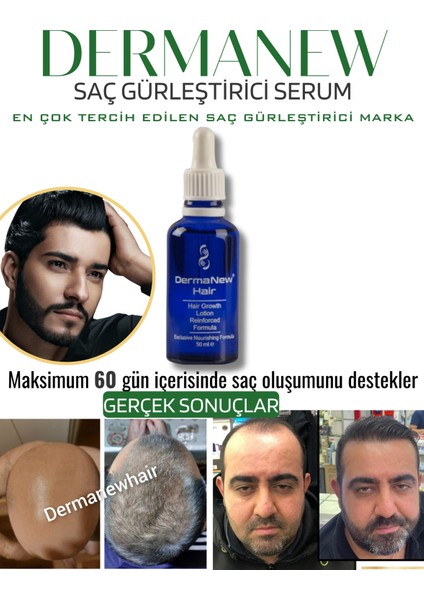 Dermanew Hair Losyon / 5 Losyon +Roller +Şampuan