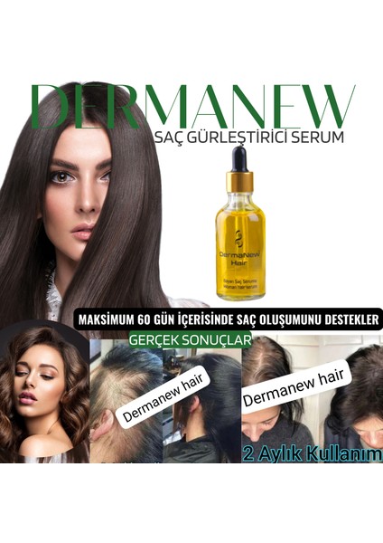 Dermanew Hair Losyon / 5 Losyon +Roller