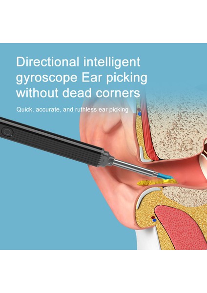 Ne3 Pro Akıllı Kulak Wax Temizleme Temizleyici ile Hd Kamera LED Işık Kablosuz Otoskop Alet Takımı Siyah (Yurt Dışından)