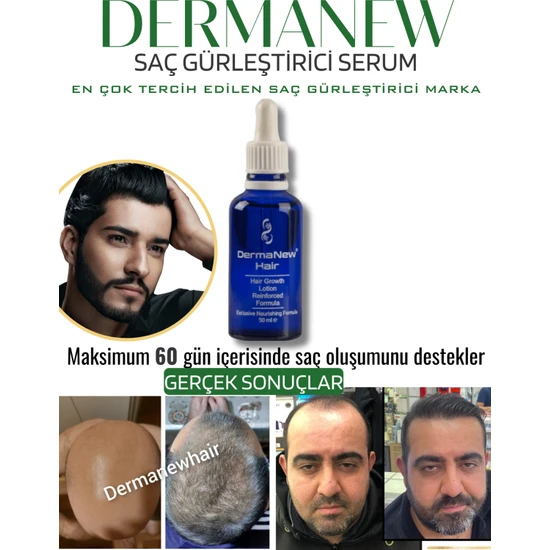 Dermanew Saç Gürleştirici Dermanew Hair Losyon / 1 Adet 1X50 ml