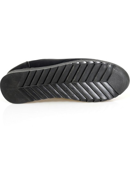 Siyah Nubuk Lastik Bağcıklı Ortopedik Kadın Ayakkabı indirimleri