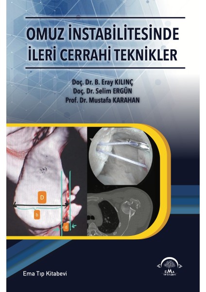 Omuz İntabilitesinde İleri Cerrahi Teknikler