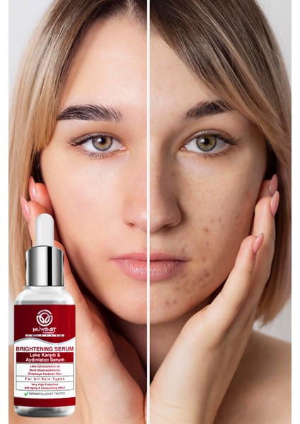 Naturel Leke Karşıtı Aydınlatıcı Serum