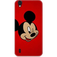 Teknomeg Vestel Venüs 5000 Mickey Mouse Desenli Silikon Kılıf
