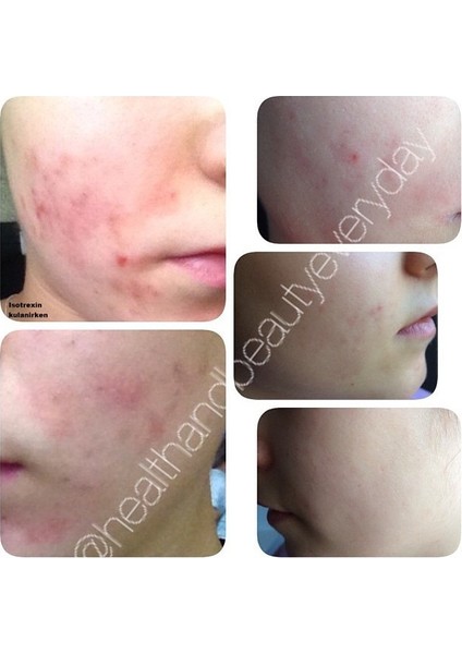 Lr Microsilver Plus - Yüz Kremi - modelleri