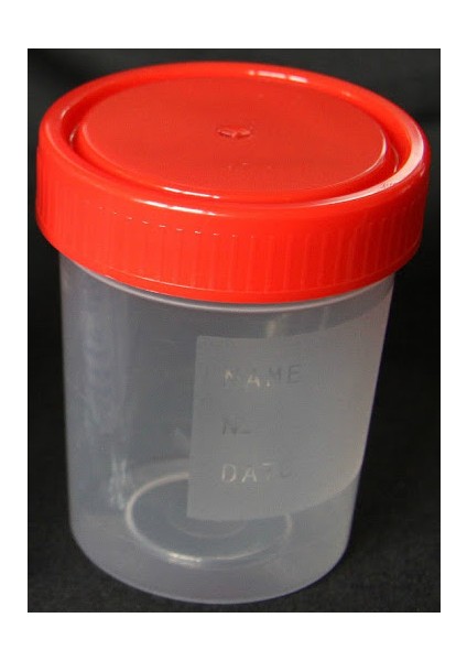 Numune Kabı Steril 100 ml