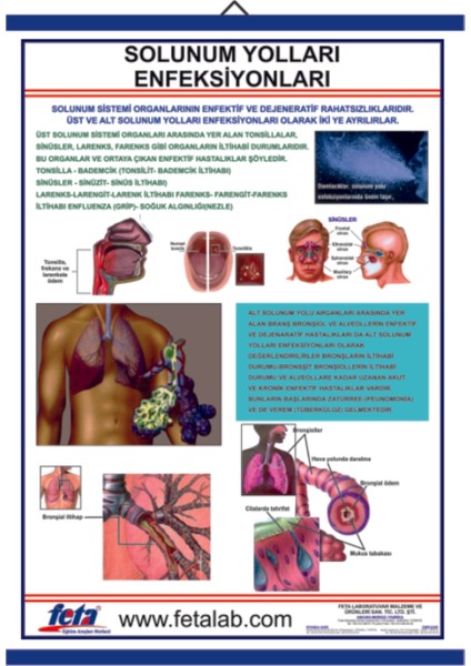Solunum Yolları Enfeksiyonları Eğitim Plakası